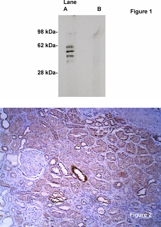 Fig 1. Western blot on human brain lysate (10 ug/lane) using Exalpha’s X2059P antibody to Sphingomyelin Synthase 2 (0.5 ug/ml). Lane A] 1 ug/ml antibody alone, lane B] antibody plus 3 ug blocking peptide. Blot was developed with Pierce’s Super Sytem West Femto - 1 minute exposure. Fig 2. Human kidney section stained with Exalpha’s anti-SMS-2 antibody (Cat X2059P) at 2 ug/ml. Anti-rabbit Ig H+L HRP conjugate (5 ug/ml) without antigen retrieval.
